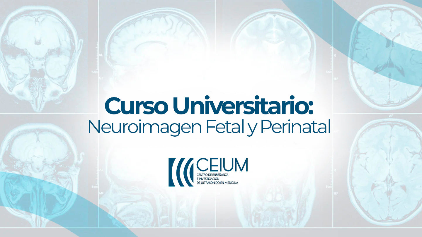 Curso Universitario: Neuroimagen Fetal y Perinatal