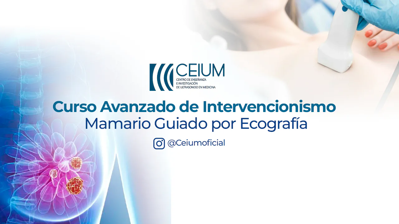 Curso Avanzado de Intervencionismo Mamario Guiado por Ecografía